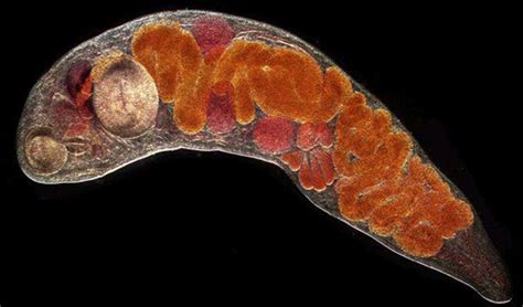 Taiwan Trematode: A Tiny Terror Lurking in Freshwater Snails – Exploring the Fascinating Life Cycle of a Parasitic Flatworm!